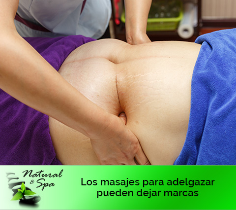 Masajes para adelgazar Bogotá, mujer haciendo masajes en el abdomen a otra
